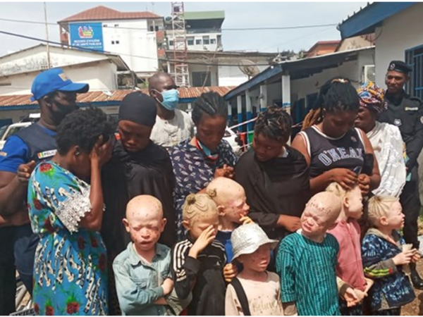 Conakry: Un groupe de femmes arrêté pour l’exploitation des enfants albinos à la&nbsp;mendicité